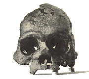 [skull image]